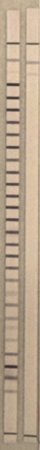 Sample immunoblot pair with a positive strip on the left and a negative strip on the right